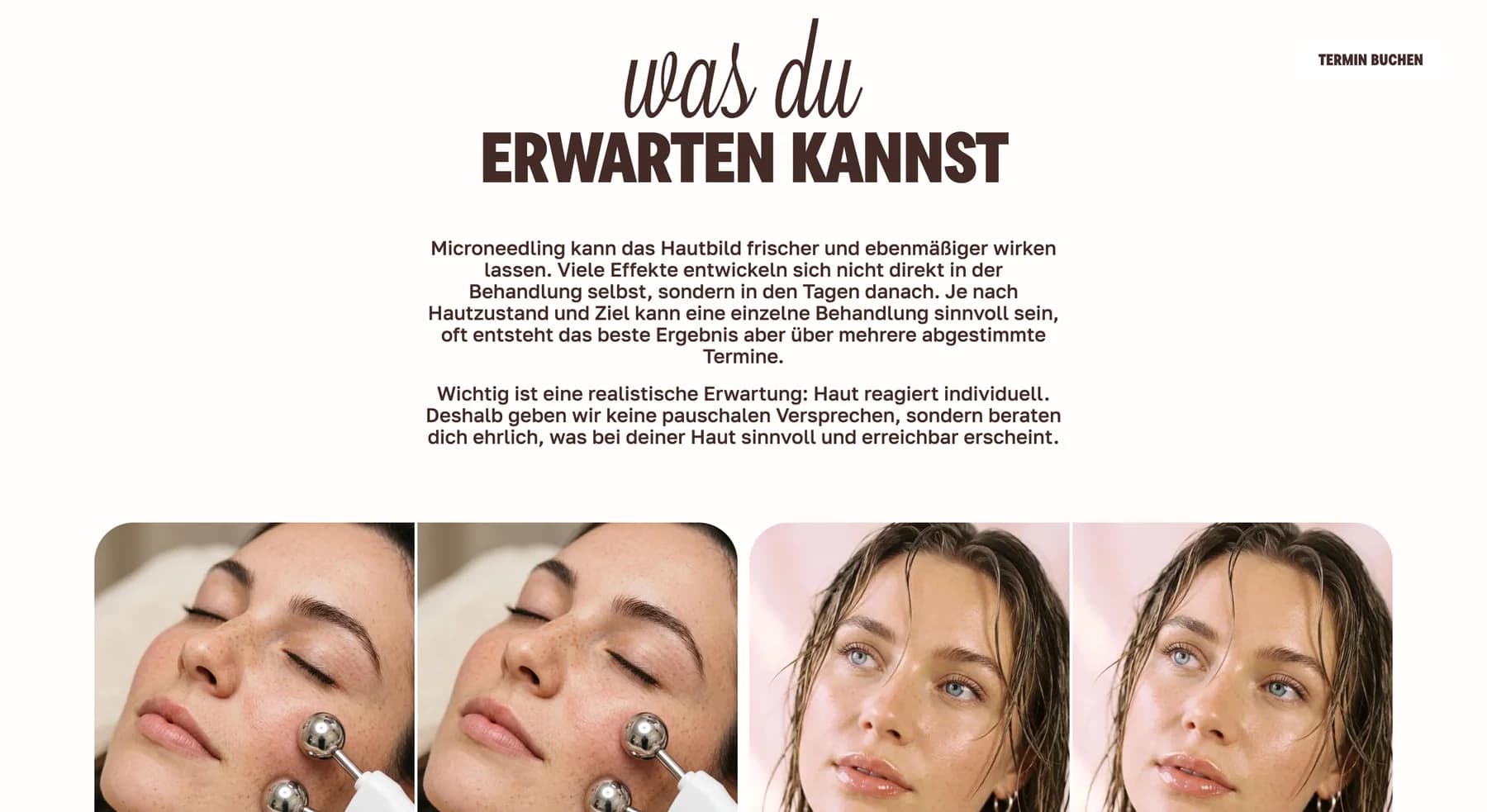 Editoriale Microneedling-Sektion mit Portraitfotografie